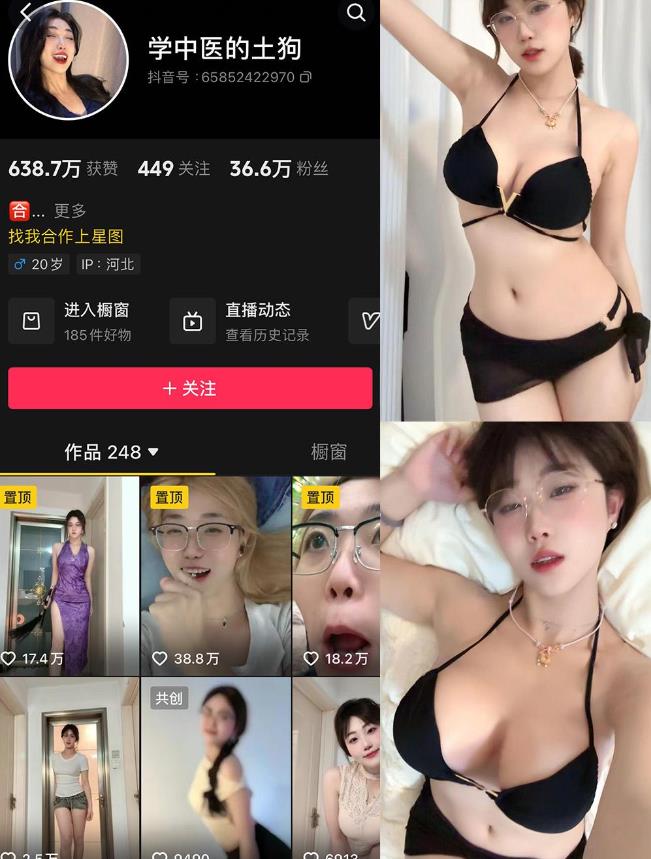 学中医的土狗 微密圈 001-002图册整合